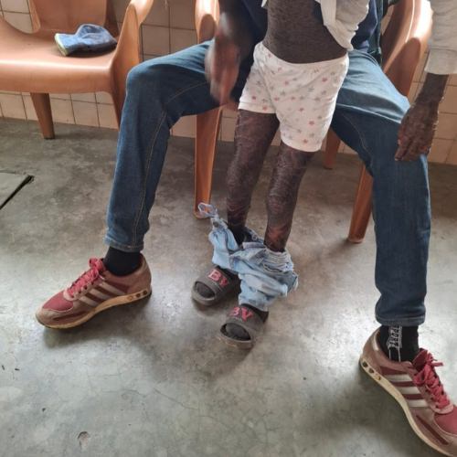 thumbnail of the legs of a boy with a skin affliction